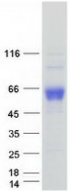 Coomassie blue staining of purified CD33 protein.